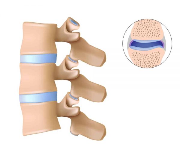 Conditions London Back Pain Clinic